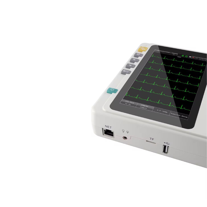 ecg3